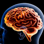 metal in the brain identified